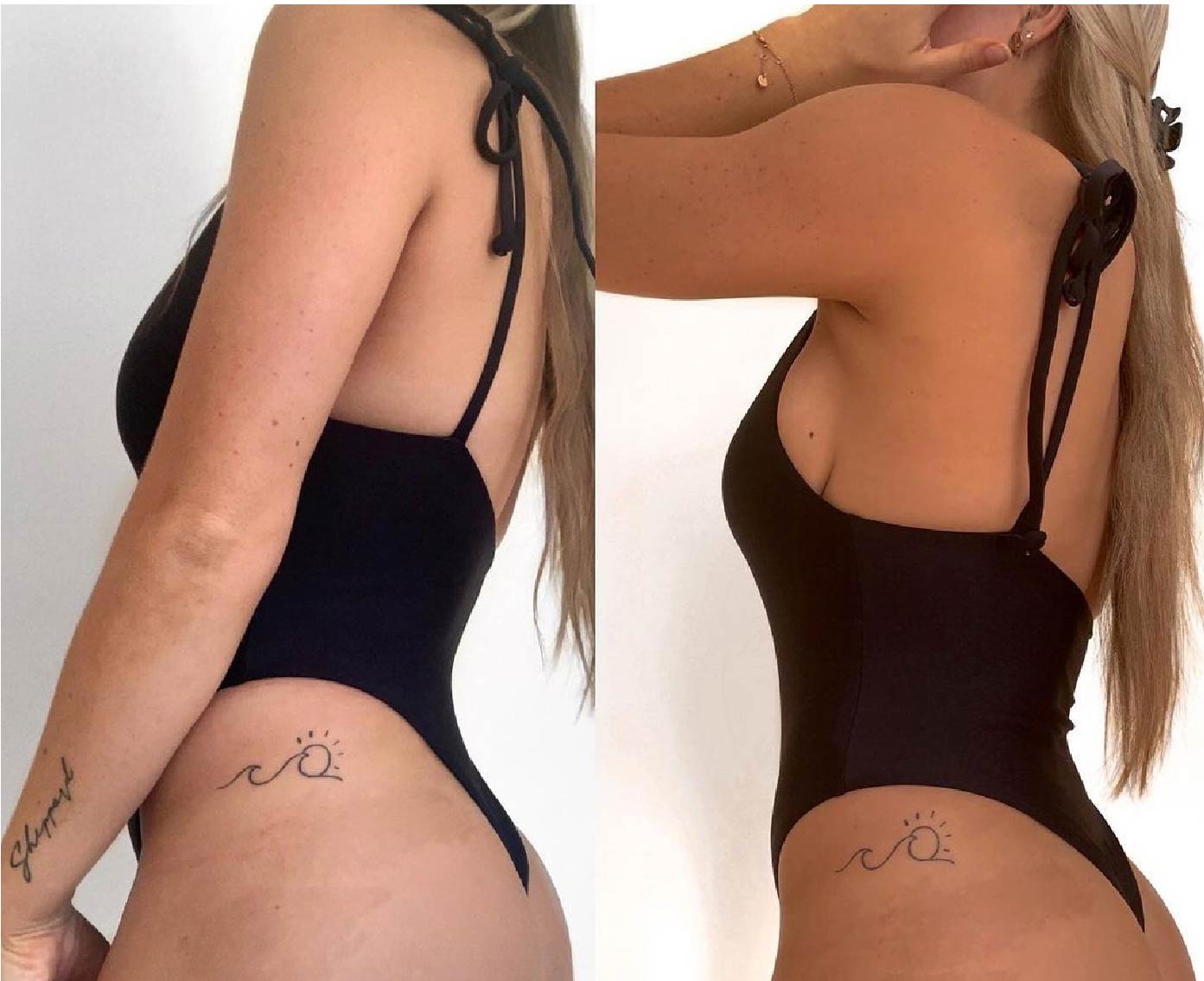 Karen T. - Best Self-Tanner I've Ever Used