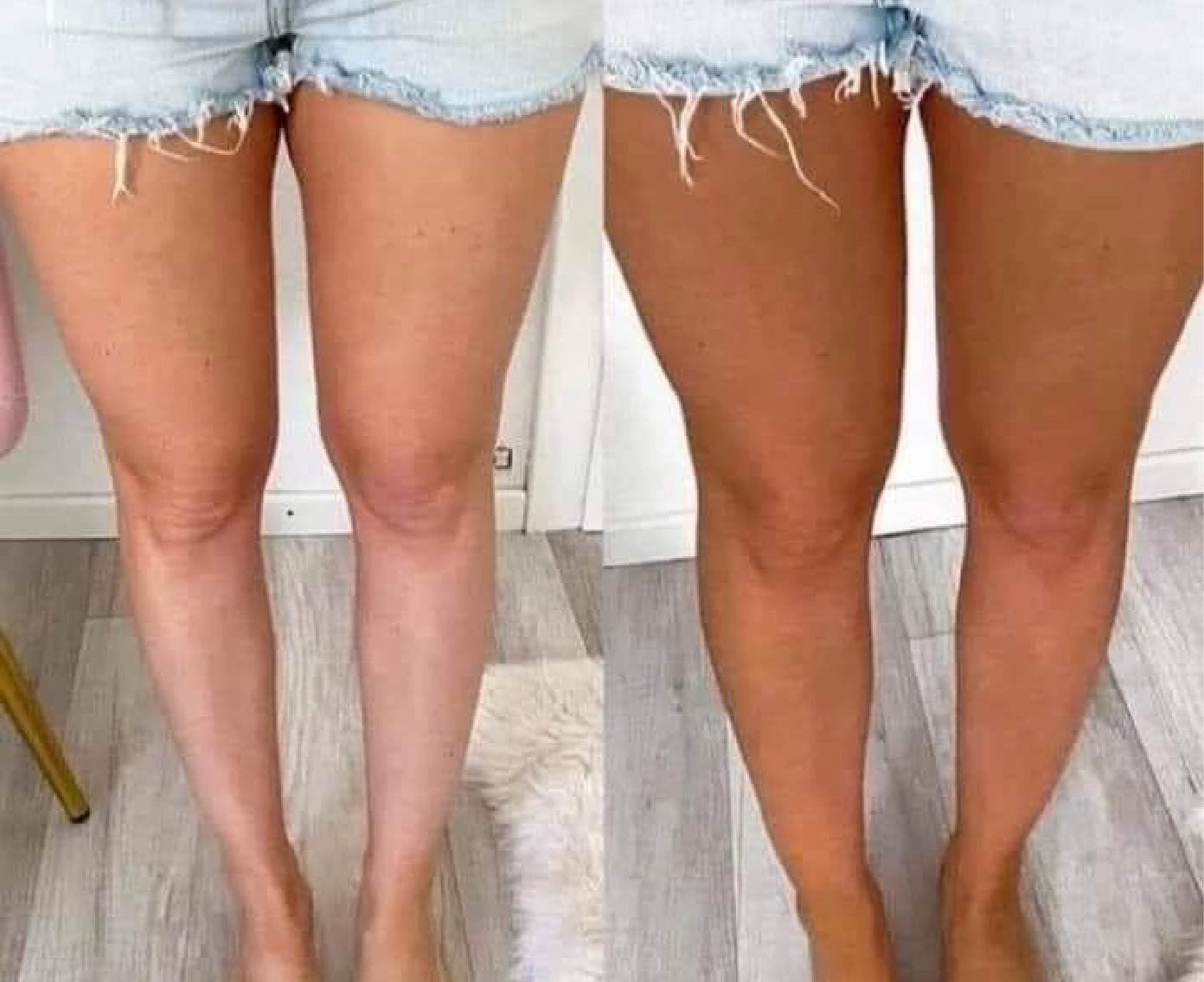 Barbara J. - So Happy With My Glow